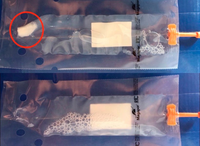 Photo 2. Dans la partie supérieure de l'image, dose avec sédimentation séminale, dans la partie inférieure, dose correctement homogénéisée. Cette homogénéisation évitera la perte de viabilité des spermatozoïdes et la meilleure répartition de ceux-ci dans le milieu.