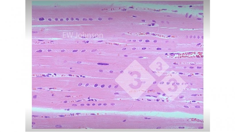 Figure 3. Muscle cardiaque avec hémorragie, nécrose hyaline et alignement des noyaux montrant une carence en vitamine E et en sélénium. Ces porcs n'auraient pas un système immunitaire fonctionnant normalement.